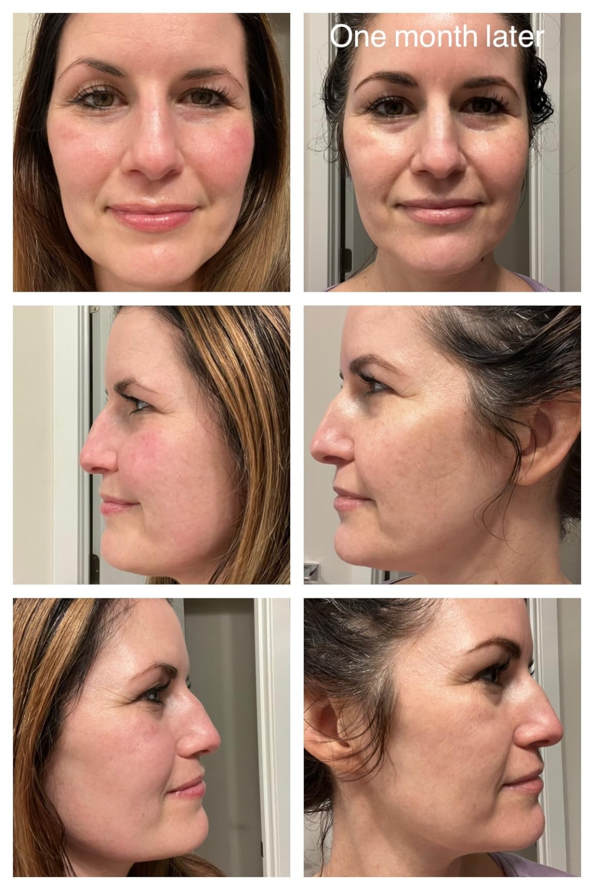 CeraVe Skin Renewing Vitamin C Serum 30ml | Brightening, Anti-Aging & Hydrating